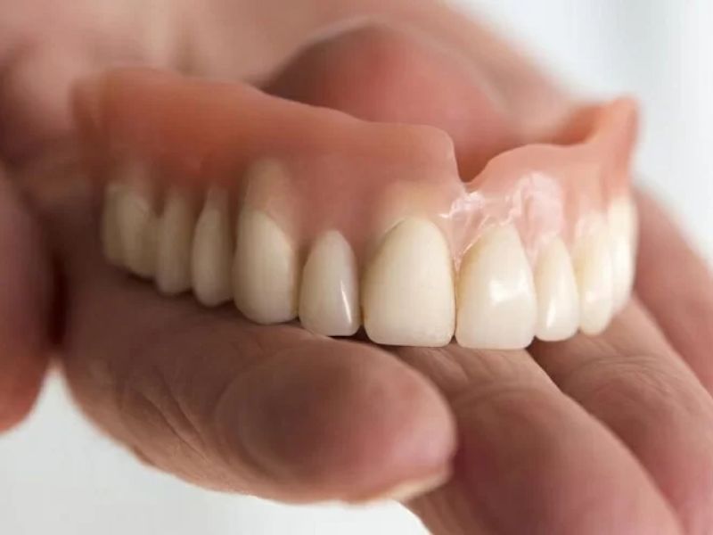 Nhìn thấy răng giả con số nào đẹp?