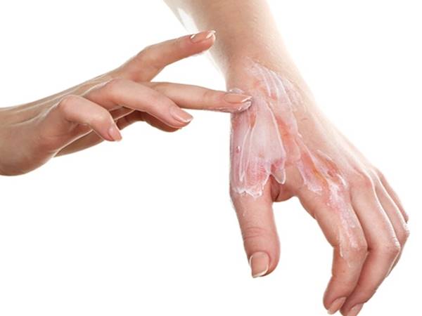 Điềm báo ý nghĩa thấy thấy bị bỏng nước sôi