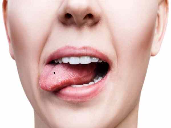 Nốt ruồi ở lưỡi có vận mệnh tướng số ra sao? tốt hay xấu?