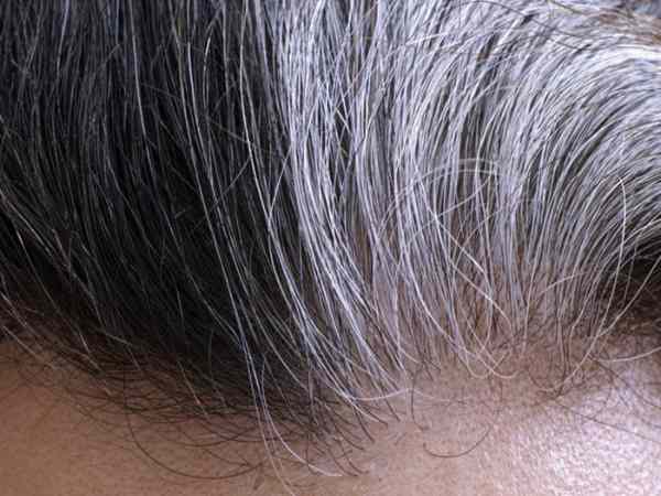 Nhìn thấy tóc bạc số đẹp nào?
