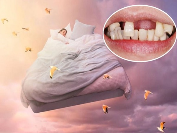 Giải mã mơ thấy bị rụng răng là điềm lành hay điềm dữ?